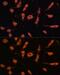 Transmembrane Protein 173 antibody, GTX33549, GeneTex, Immunofluorescence image 
