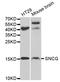 Synuclein Gamma antibody, A03523-2, Boster Biological Technology, Western Blot image 