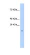 Chymotrypsin-like protease CTRL-1 antibody, NBP1-58002, Novus Biologicals, Western Blot image 