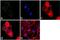 Protein Tyrosine Kinase 2 antibody, NBP2-68146, Novus Biologicals, Immunofluorescence image 