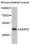 ArfGAP With Dual PH Domains 2 antibody, 15-175, ProSci, Western Blot image 