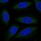 ALG6 Alpha-1,3-Glucosyltransferase antibody, PA5-66504, Invitrogen Antibodies, Immunofluorescence image 