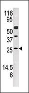 Adenylate Kinase 4 antibody, AP15104PU-N, Origene, Western Blot image 