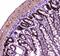 SWI/SNF Related, Matrix Associated, Actin Dependent Regulator Of Chromatin, Subfamily A, Member 4 antibody, A00223-1, Boster Biological Technology, Immunohistochemistry paraffin image 