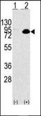 Nuclear Factor Kappa B Subunit 2 antibody, orb256720, Biorbyt, Western Blot image 