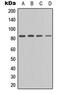 Protein Kinase C Epsilon antibody, LS-C368477, Lifespan Biosciences, Western Blot image 