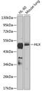 H2.0 Like Homeobox antibody, 14-911, ProSci, Western Blot image 
