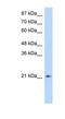 Fer3 Like BHLH Transcription Factor antibody, NBP1-80169, Novus Biologicals, Western Blot image 