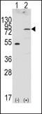 Fibroblast Growth Factor Receptor 4 antibody, PA5-14657, Invitrogen Antibodies, Western Blot image 