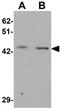 LIM homeobox transcription factor 1-beta antibody, GTX31508, GeneTex, Western Blot image 