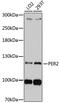 Period Circadian Regulator 2 antibody, MBS126915, MyBioSource, Western Blot image 