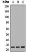 Rho Family GTPase 2 antibody, orb234954, Biorbyt, Western Blot image 