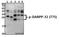 Protein Phosphatase 1 Regulatory Inhibitor Subunit 1B antibody, A03424T75, Boster Biological Technology, Western Blot image 