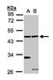 Choline Kinase Beta antibody, NBP1-31606, Novus Biologicals, Western Blot image 