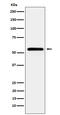 Calcium/Calmodulin Dependent Protein Kinase II Alpha antibody, M03241-2, Boster Biological Technology, Western Blot image 