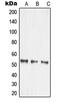 Matrix Metallopeptidase 14 antibody, LS-C352538, Lifespan Biosciences, Western Blot image 