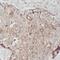 Transmembrane Protein 199 antibody, FNab08768, FineTest, Immunohistochemistry paraffin image 