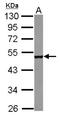 Cytoplasmic Polyadenylation Element Binding Protein 1 antibody, NBP2-15981, Novus Biologicals, Western Blot image 