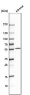 Cytochrome P450 Family 17 Subfamily A Member 1 antibody, NBP2-13892, Novus Biologicals, Western Blot image 