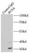PCNA antibody, FNab06217, FineTest, Immunoprecipitation image 