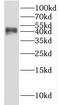 Isocitrate Dehydrogenase (NADP(+)) 1, Cytosolic antibody, FNab04118, FineTest, Western Blot image 