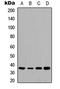 Transmembrane BAX Inhibitor Motif Containing 1 antibody, LS-C358358, Lifespan Biosciences, Western Blot image 