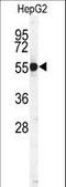 Cathepsin H antibody, LS-C100568, Lifespan Biosciences, Western Blot image 