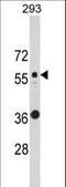 Keratin 10 antibody, LS-B10950, Lifespan Biosciences, Western Blot image 