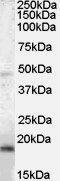 BAALC Binder Of MAP3K1 And KLF4 antibody, GTX89453, GeneTex, Western Blot image 