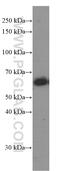 C-X-C Motif Chemokine Receptor 4 antibody, 60042-1-Ig, Proteintech Group, Western Blot image 