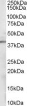 Sorbitol Dehydrogenase antibody, NB100-1486, Novus Biologicals, Western Blot image 