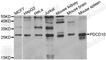 Programmed Cell Death 10 antibody, A2786, ABclonal Technology, Western Blot image 