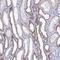 Acyl-CoA Synthetase Medium Chain Family Member 1 antibody, HPA046291, Atlas Antibodies, Immunohistochemistry frozen image 