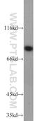 HPS6 Biogenesis Of Lysosomal Organelles Complex 2 Subunit 3 antibody, 11371-1-AP, Proteintech Group, Western Blot image 