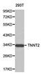 Troponin T2, Cardiac Type antibody, orb129754, Biorbyt, Western Blot image 