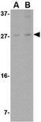 Mesencephalic Astrocyte Derived Neurotrophic Factor antibody, GTX31325, GeneTex, Western Blot image 