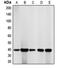 Cyclin Dependent Kinase 7 antibody, LS-C351976, Lifespan Biosciences, Western Blot image 
