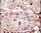 Aurora Kinase B antibody, PA5-14076, Invitrogen Antibodies, Immunohistochemistry paraffin image 