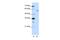 Zinc Finger Protein 497 antibody, PA5-69060, Invitrogen Antibodies, Western Blot image 