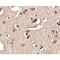 SLIT And NTRK Like Family Member 2 antibody, LS-C53253, Lifespan Biosciences, Immunohistochemistry paraffin image 