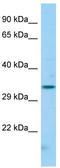Fc Fragment Of IgG Receptor IIc (Gene/Pseudogene) antibody, TA333329, Origene, Western Blot image 