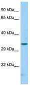 Low affinity immunoglobulin gamma Fc region receptor II-c antibody, TA333329, Origene, Western Blot image 