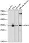 Cyclin Dependent Kinase 4 antibody, 13-006, ProSci, Western Blot image 