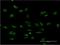 PMS1 Homolog 2, Mismatch Repair System Component antibody, H00005395-M05, Novus Biologicals, Immunocytochemistry image 