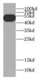 Cbl Proto-Oncogene C antibody, FNab01319, FineTest, Western Blot image 