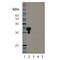 Sirtuin 5 antibody, A02395, Boster Biological Technology, Western Blot image 