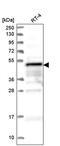 Zinc finger FYVE domain-containing protein 19 antibody, PA5-65320, Invitrogen Antibodies, Western Blot image 