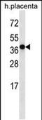 Olfactory Receptor Family 5 Subfamily H Member 2 antibody, PA5-48731, Invitrogen Antibodies, Western Blot image 