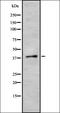 Serine And Arginine Rich Splicing Factor 6 antibody, orb337620, Biorbyt, Western Blot image 