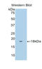 Fibronectin type III domain-containing protein 5 antibody, LS-C297398, Lifespan Biosciences, Western Blot image 